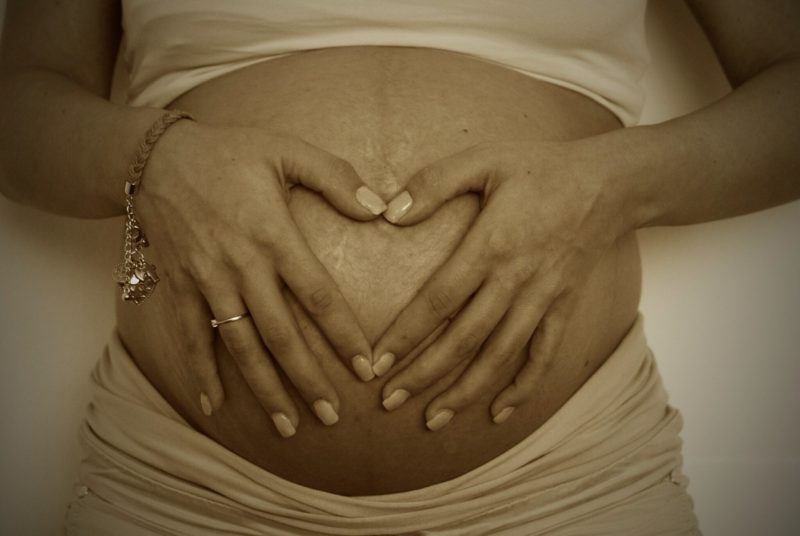 産後の妊娠線